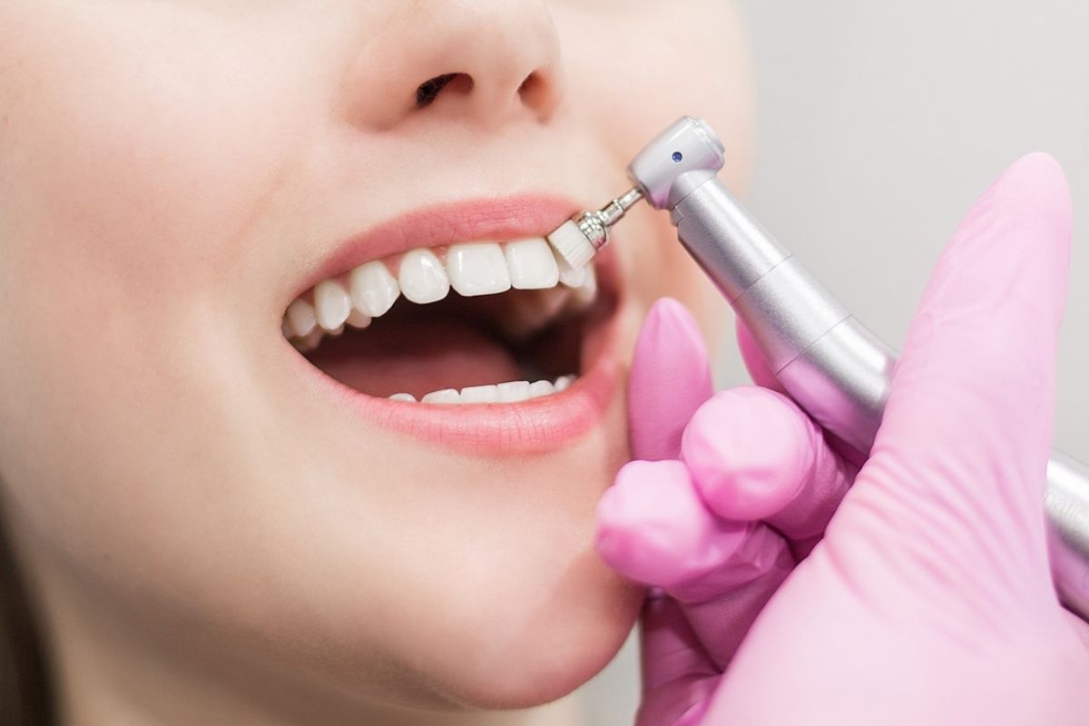 Teeth Whitening with Gum Disease