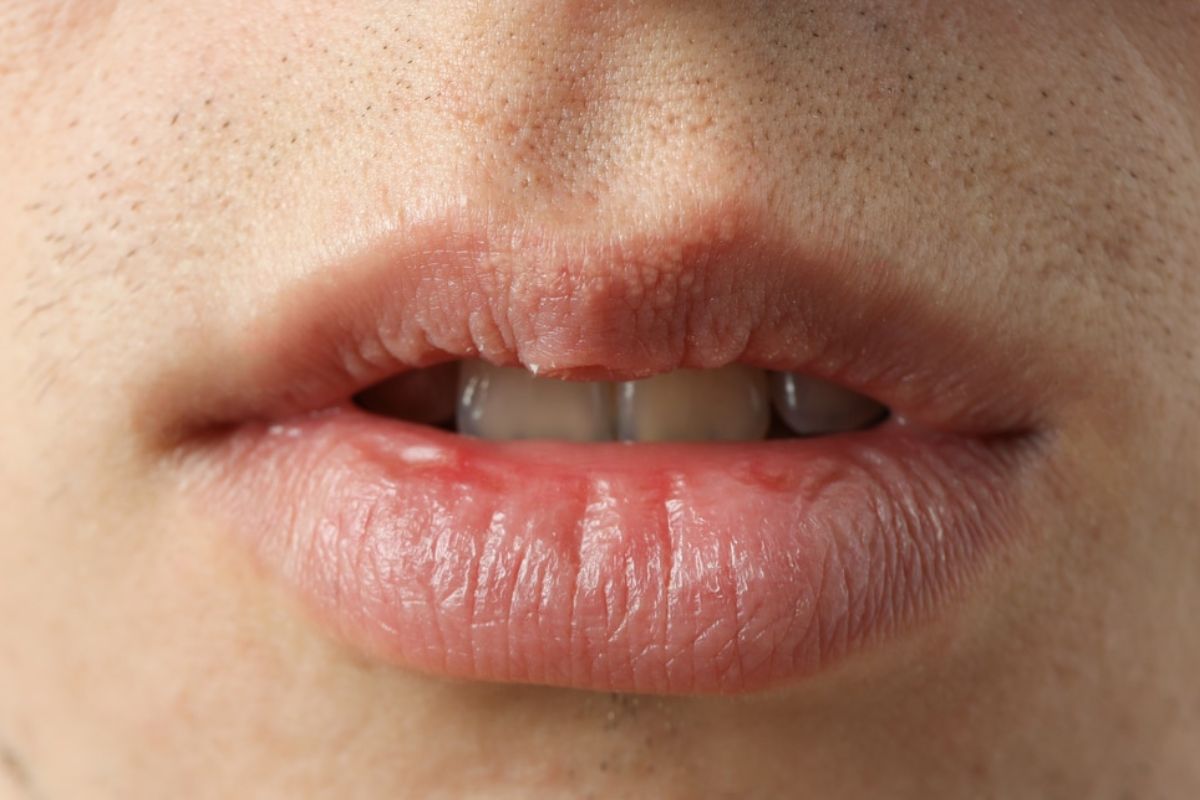 Causes of Sudden Dry Mouth