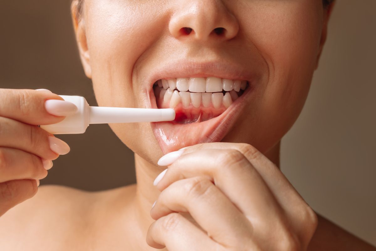 swollen gums
