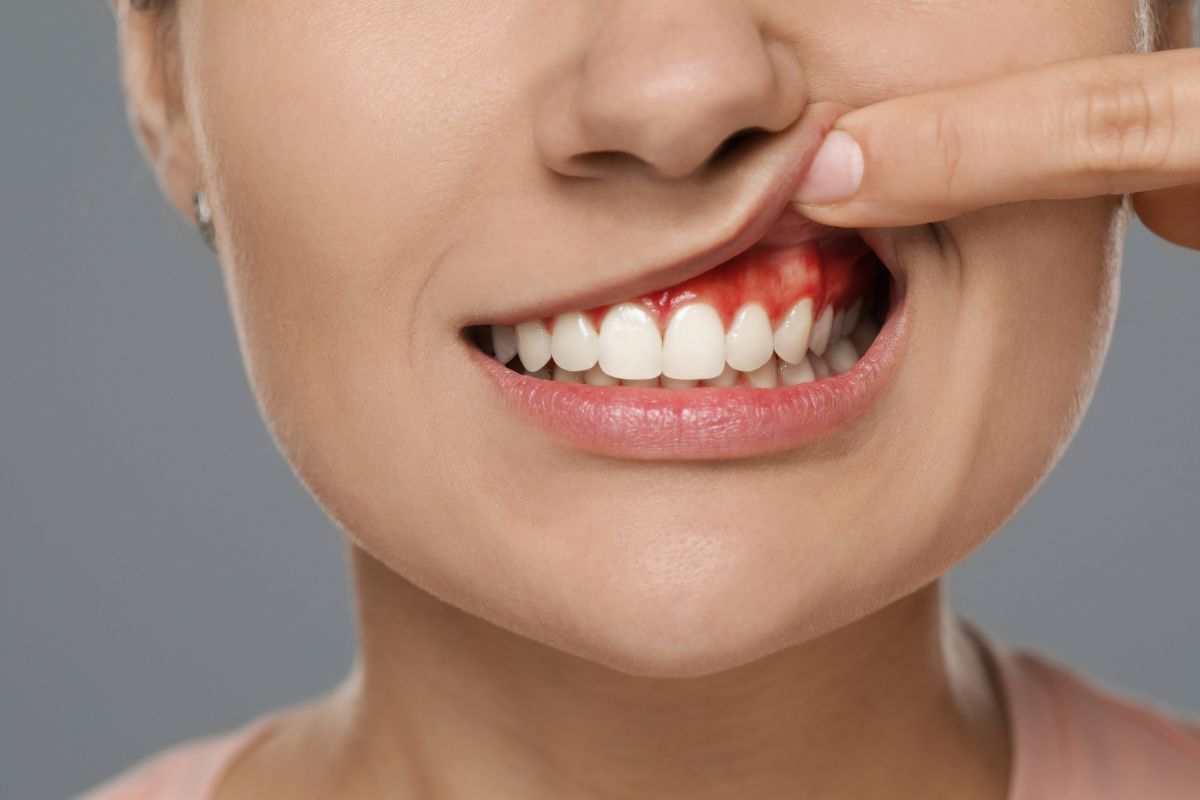 emergency dentist in bel air