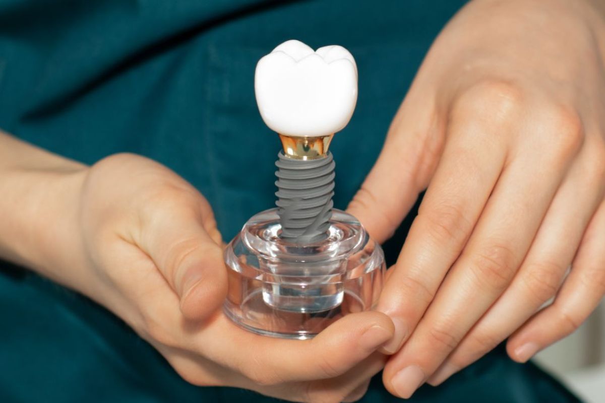 dental implants