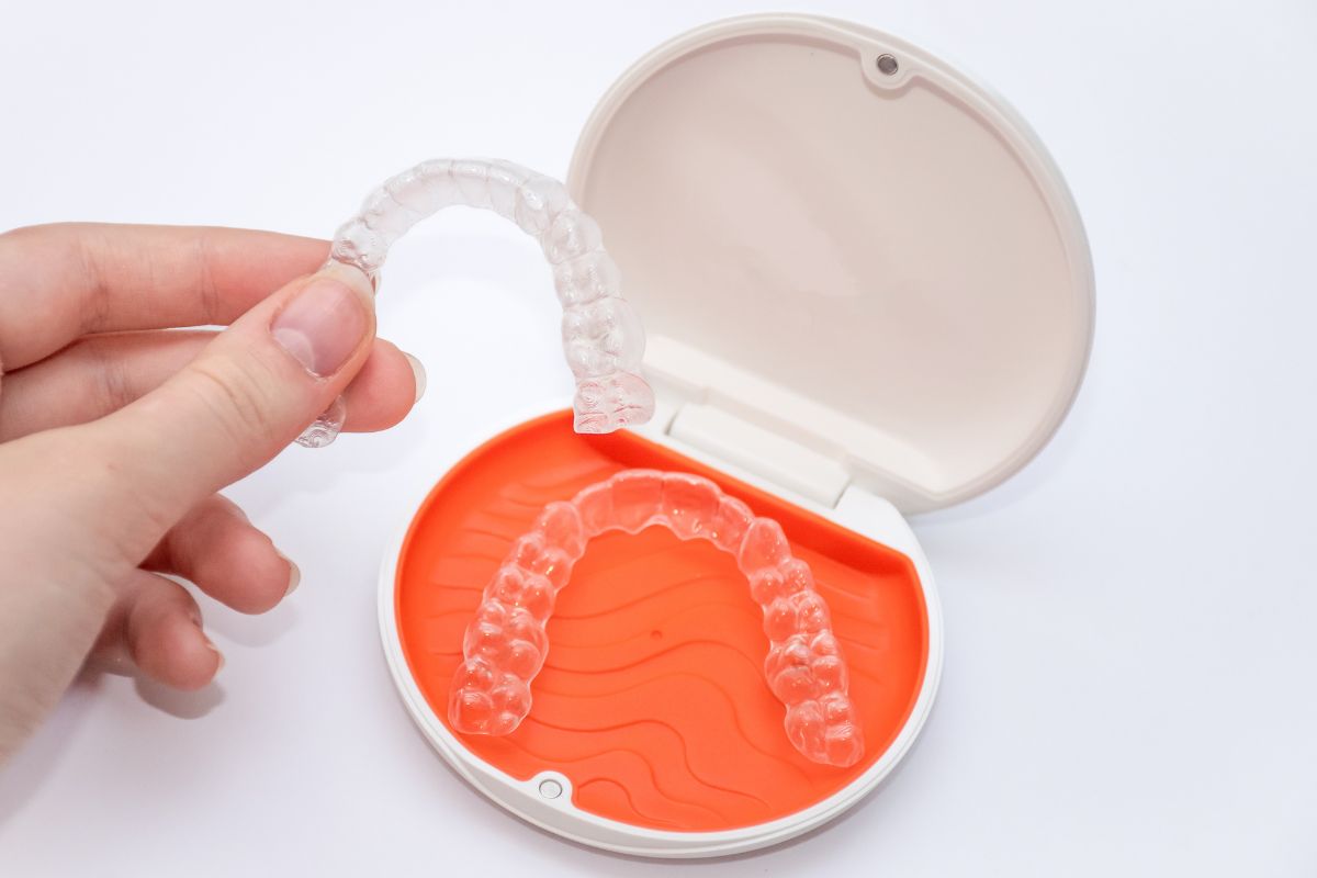 clear aligners