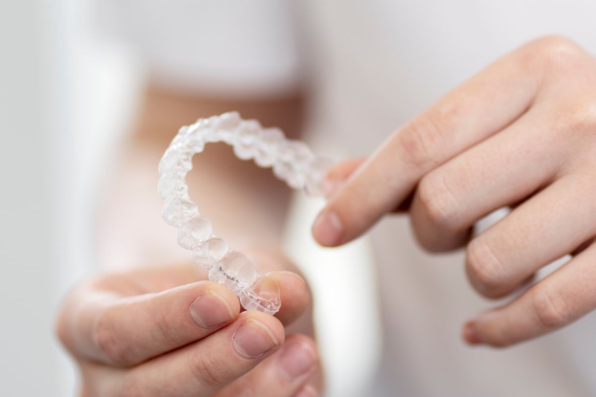 invisalign aligners