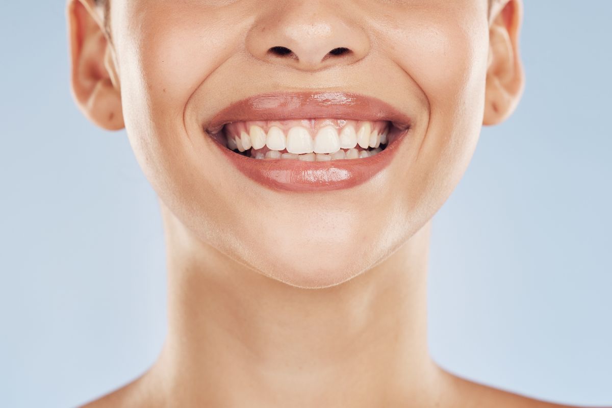 Using Vaseline on Teeth