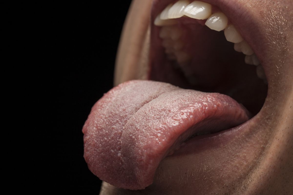 Tongue Bumps