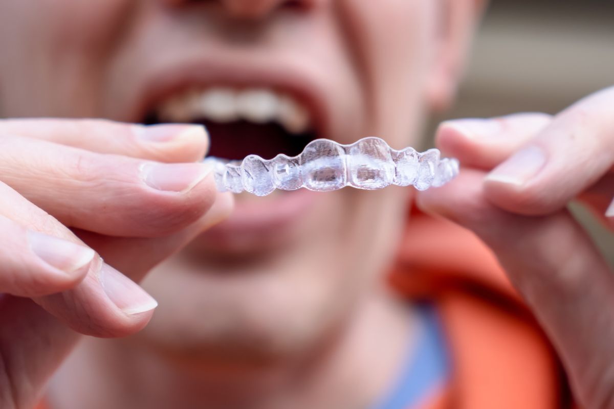Close-up of a clear Invisalign aligner tray held in hands, showing proper fit and transparency.