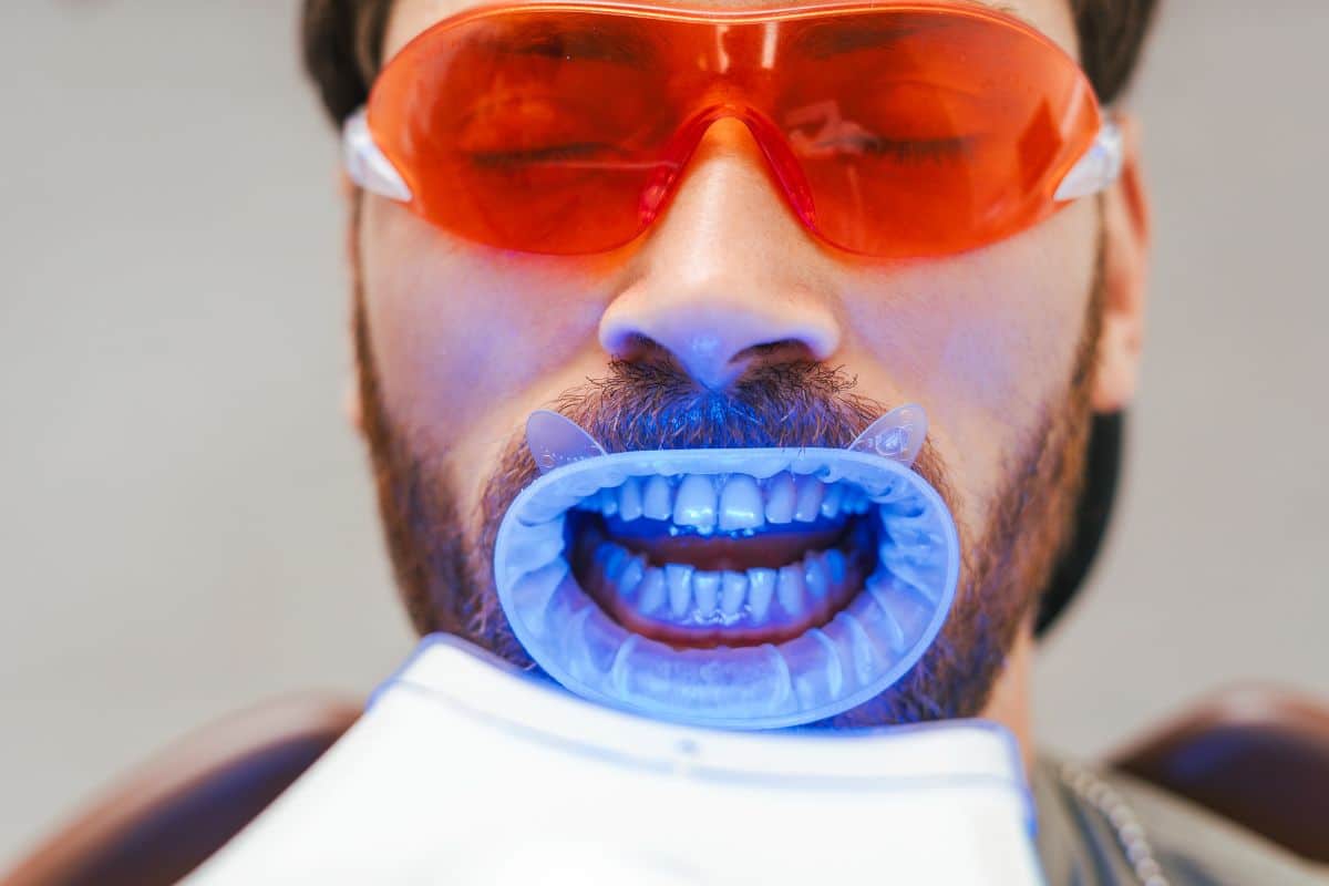 zoom teeth whitening